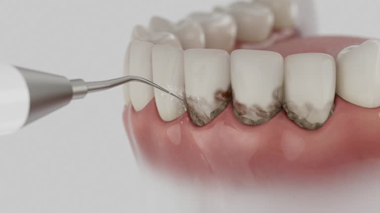 Trusted Teeth Whitening service in Cleburne, TX - Dentist Open Now